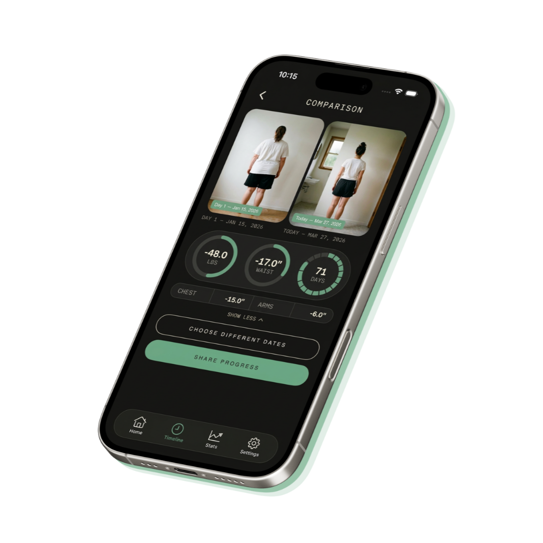 BodiTrack app — before and after comparison view